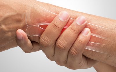 Hoe behandel je de ziekte van De Quervain